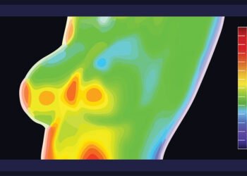Breast Thermography: Technology, Benefits, and Cancer Signs